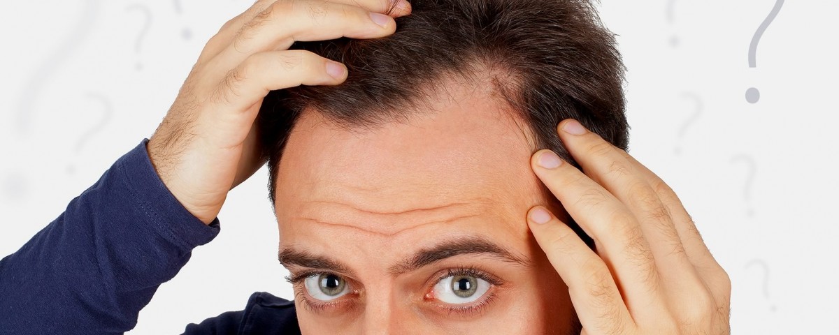 latanoprost-per-alopecia-e-caduta-dei-capelli-farmacia-graniglia